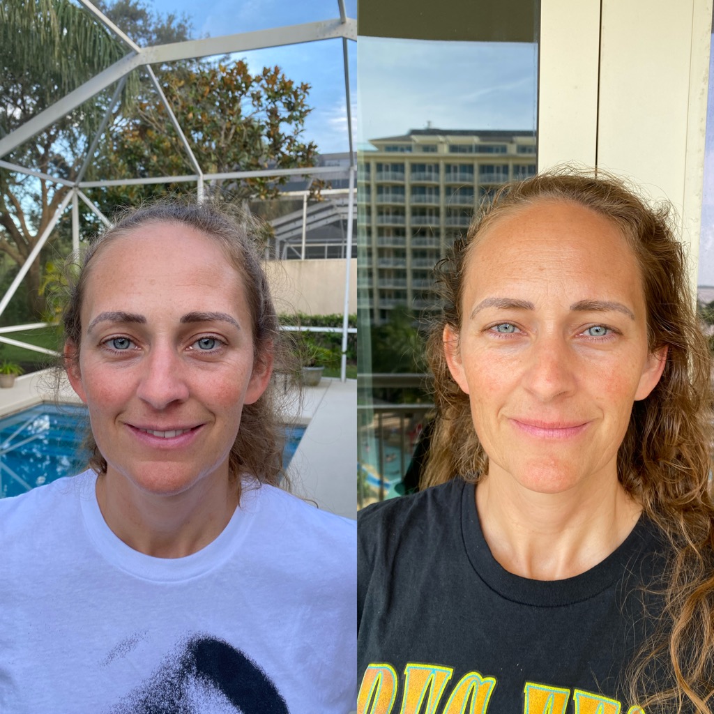Maren's results using Herbal Face Food