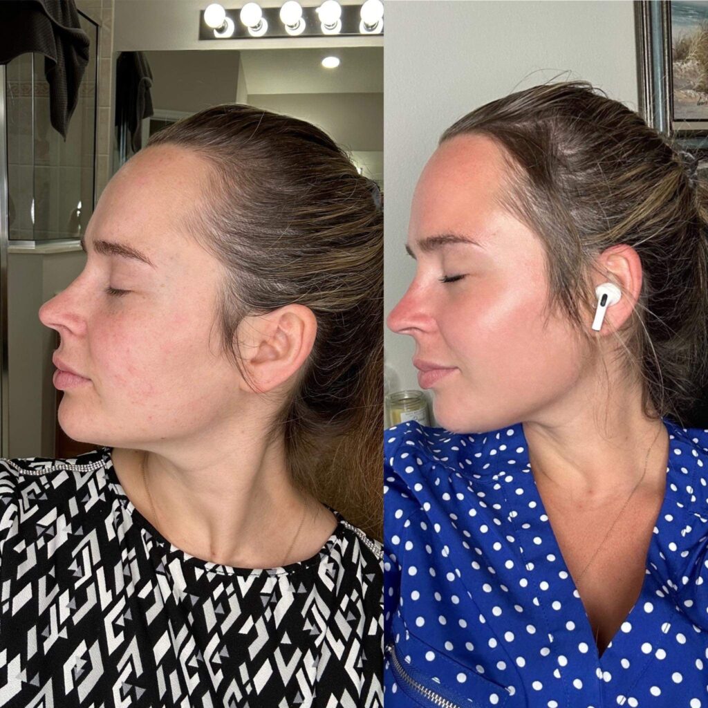 Results from using Herbal Face Food - side view